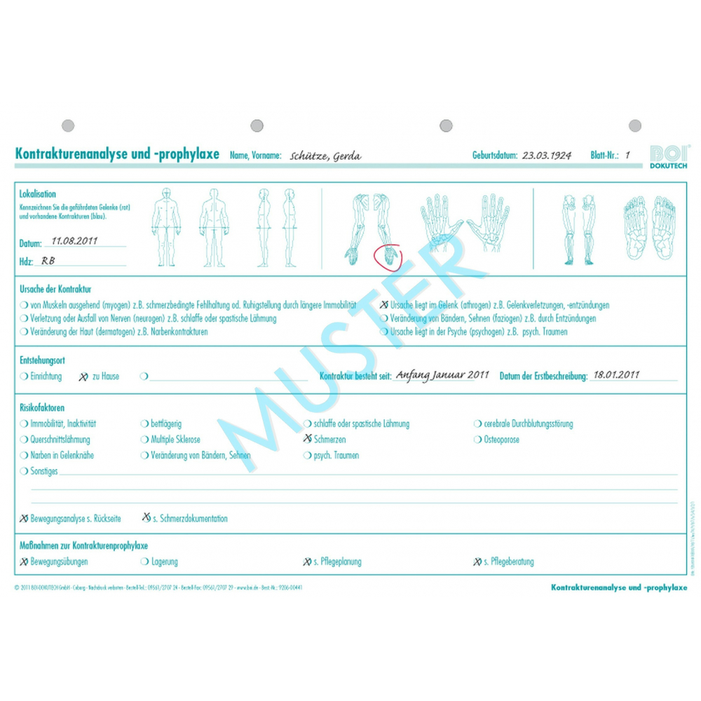 Kontrakturenanalyse und -prophylaxe