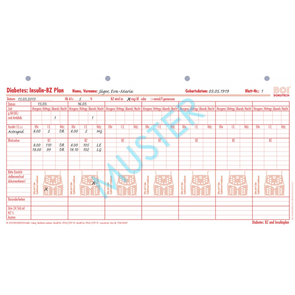 Diabetes: Insulin - BZ Plan